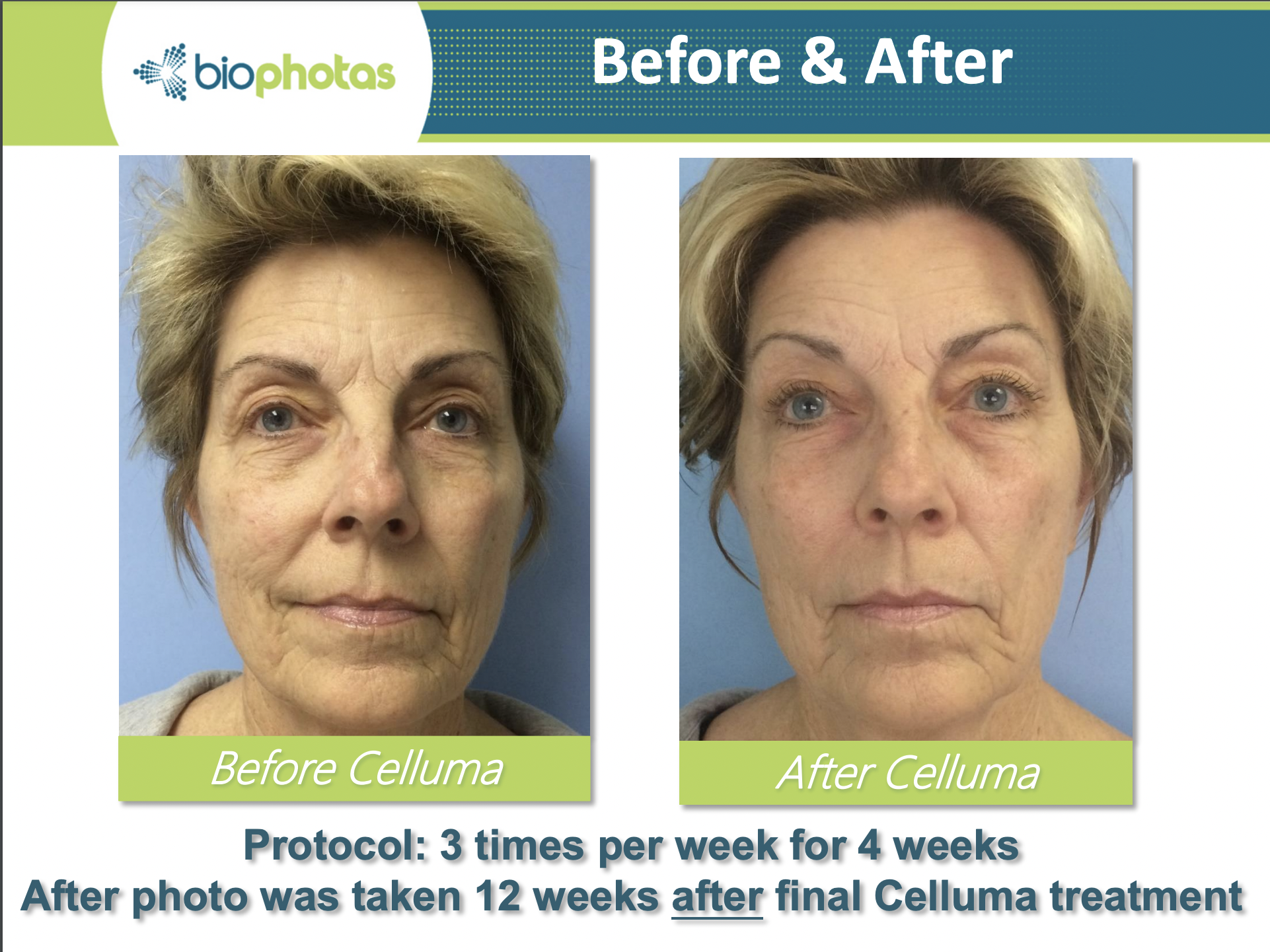 CELLUMA3