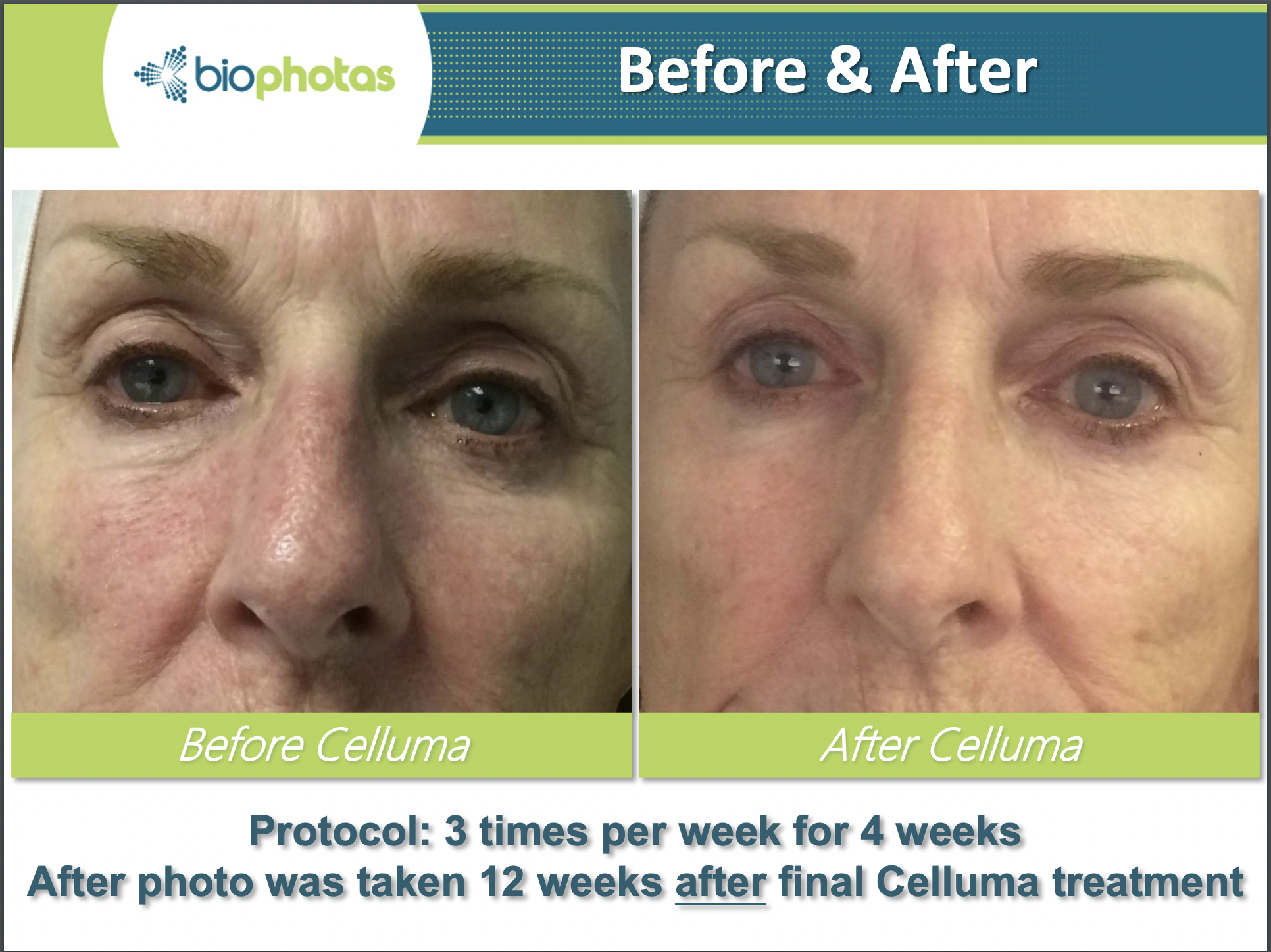 CELLUMA4